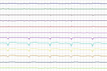 s0089lre-patient027 thumbnail