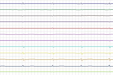 s0254lre-patient077 thumbnail
