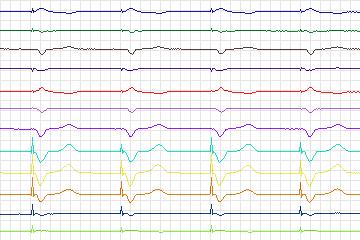 s0256lre-patient079 thumbnail