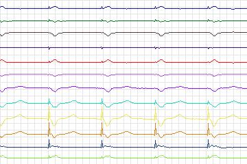 s0257lre-patient079 thumbnail