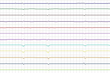 s0259lre-patient078 thumbnail