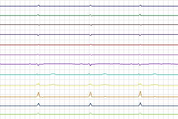 s0269lre-patient079 thumbnail