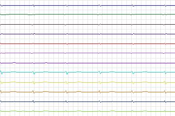 s0285lre-patient077 thumbnail