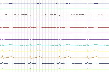 s0396lre-patient093 thumbnail